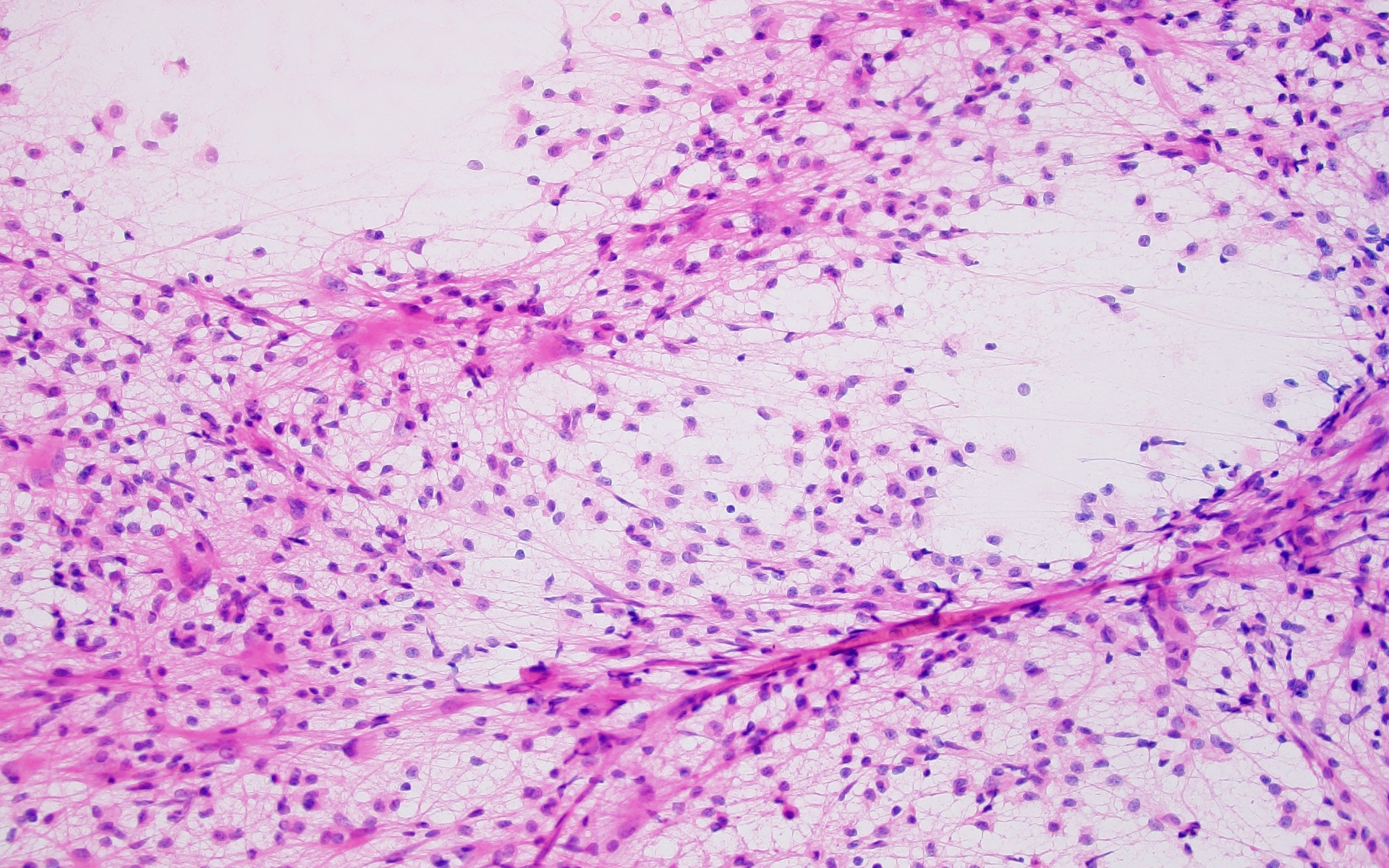 Targeting DEs: Discovering Novel Autoimmune Cures Featured Image